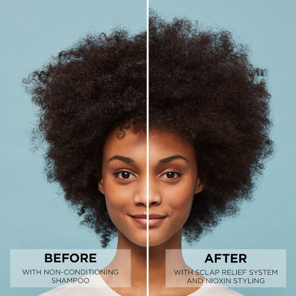 Nioxin_Scalp
