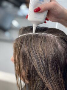 scalp clinix oil treatment