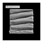 λιπαρά μαλλιά