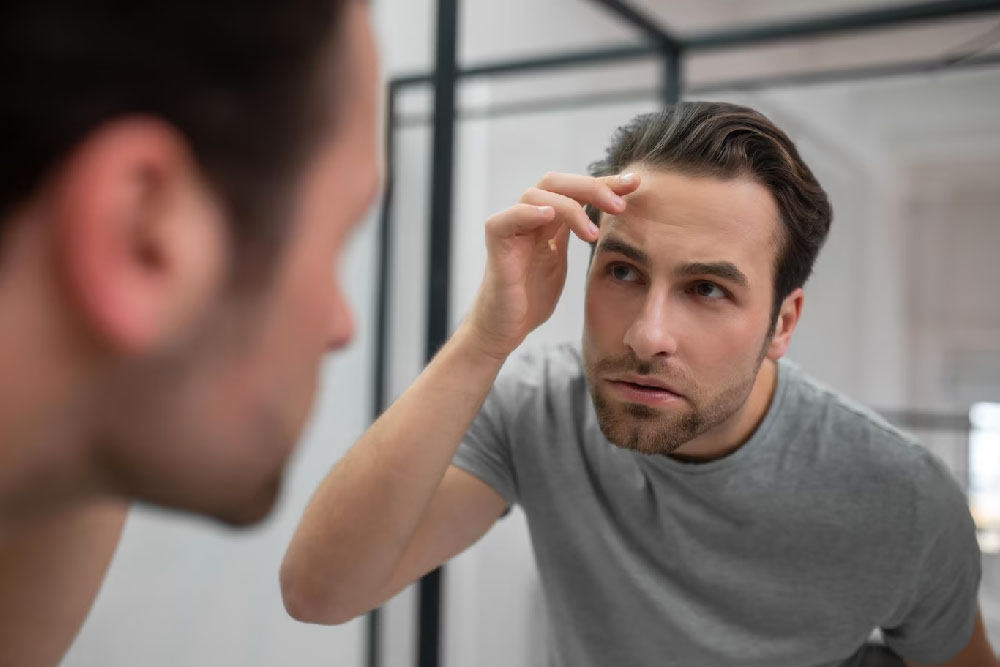 Πότε και γιατί εμφανίζεται η εποχική ανδρική τριχόπτωση;