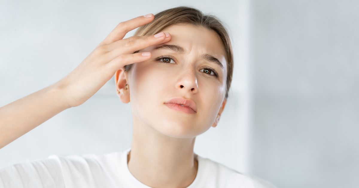 Λιπαρή επιδερμίδα Αντιμετώπιση με 6 skincare συμβουλές